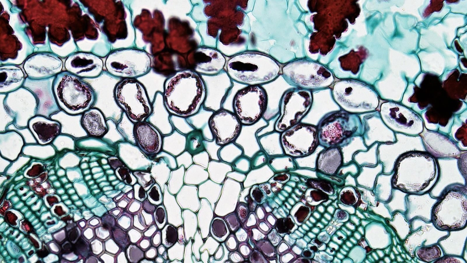 Stained plant tissue under a microscope showing plant cells and vascular tissue where mitochondria are found